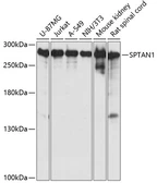 Anti-alpha Fodrin antibody used in Western Blot (WB). GTX66033