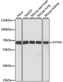 Anti-SYVN1 antibody used in Western Blot (WB). GTX66037