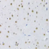Anti-SFRS3 antibody used in IHC (Paraffin sections) (IHC-P). GTX66040