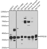 Anti-RPRD1B antibody used in Western Blot (WB). GTX66048