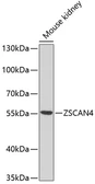 Anti-ZSCAN4C antibody used in Western Blot (WB). GTX66052