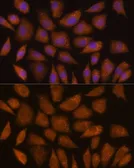 Anti-GCLC antibody used in Immunocytochemistry/ Immunofluorescence (ICC/IF). GTX66057