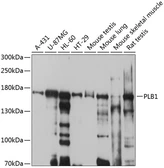 Anti-PLB1 antibody used in Western Blot (WB). GTX66060