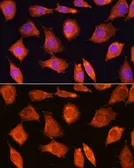 Anti-SEC11A antibody used in Immunocytochemistry/ Immunofluorescence (ICC/IF). GTX66062