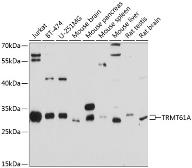Anti-TRMT61A antibody used in Western Blot (WB). GTX66064