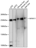Anti-Myosin Heavy Chain 11 antibody used in Western Blot (WB). GTX66065