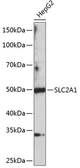 Anti-GluT1 antibody used in Western Blot (WB). GTX66071