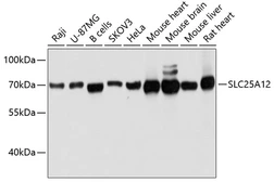 Anti-ARALAR antibody used in Western Blot (WB). GTX66079