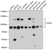Anti-POLK antibody used in Western Blot (WB). GTX66084