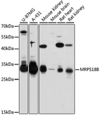 Anti-MRPS18B antibody used in Western Blot (WB). GTX66086