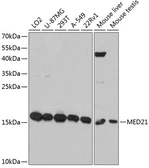 Anti-Surb7 antibody used in Western Blot (WB). GTX66091