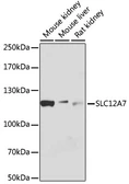 Anti-KCC4 antibody used in Western Blot (WB). GTX66096