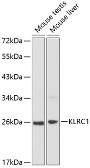 Anti-NKG2A antibody used in Western Blot (WB). GTX66098