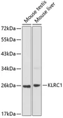 Anti-NKG2A antibody used in Western Blot (WB). GTX66098