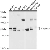 Anti-SULT1A3 antibody used in Western Blot (WB). GTX66101