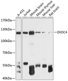 Anti-Sec8 antibody used in Western Blot (WB). GTX66103