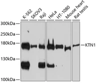 Anti-Kinectin 1 antibody used in Western Blot (WB). GTX66105