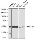 Anti-MRPS22 antibody used in Western Blot (WB). GTX66109