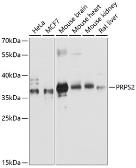 Anti-PRPS2 antibody used in Western Blot (WB). GTX66111