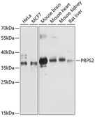 Anti-PRPS2 antibody used in Western Blot (WB). GTX66111