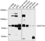 Anti-GUCY1A3 antibody used in Western Blot (WB). GTX66113
