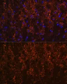 Anti-SNX13 antibody used in IHC (Paraffin sections) (IHC-P). GTX66121