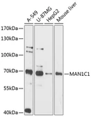 Anti-MAN1C1 antibody used in Western Blot (WB). GTX66123