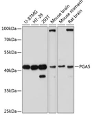 Anti-PGA5 antibody used in Western Blot (WB). GTX66144