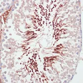 Anti-PGK2 antibody used in IHC (Paraffin sections) (IHC-P). GTX66145