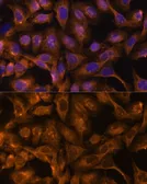 Anti-SEPT5 antibody used in Immunocytochemistry/ Immunofluorescence (ICC/IF). GTX66146