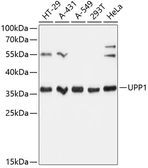 Anti-UPP1 antibody used in Western Blot (WB). GTX66155