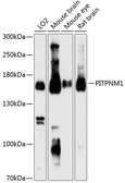Anti-NIR2 antibody used in Western Blot (WB). GTX66157