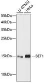 Anti-BET1 antibody used in Western Blot (WB). GTX66158