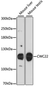 Anti-CWC22 antibody used in Western Blot (WB). GTX66164