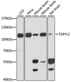 Anti-DENTT antibody used in Western Blot (WB). GTX66166