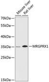 Anti-MRGX1 antibody used in Western Blot (WB). GTX66170