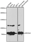 Anti-RAD26L antibody used in Western Blot (WB). GTX66172