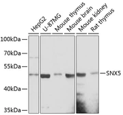 Anti-SNX5 antibody used in Western Blot (WB). GTX66173