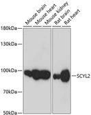 Anti-SCYL2 antibody used in Western Blot (WB). GTX66174
