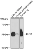 Anti-KLF10 antibody used in Western Blot (WB). GTX66176