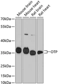 Anti-OTP antibody used in Western Blot (WB). GTX66178
