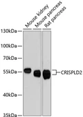 Anti-CRISPLD2 antibody used in Western Blot (WB). GTX66180