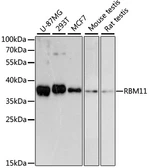 Anti-RBM11 antibody used in Western Blot (WB). GTX66184