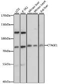 Anti-CTAGE1 antibody used in Western Blot (WB). GTX66185