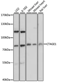 Anti-CTAGE1 antibody used in Western Blot (WB). GTX66185