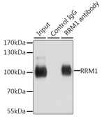Anti-RRM1 antibody used in Immunoprecipitation (IP). GTX66190