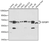 Anti-IGF2BP1 antibody used in Western Blot (WB). GTX66193