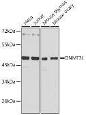 Anti-DNMT3L antibody used in Western Blot (WB). GTX66194