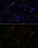 Anti-UBE2L6 antibody used in Immunocytochemistry/ Immunofluorescence (ICC/IF). GTX66195