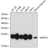 Anti-HSPC111 antibody used in Western Blot (WB). GTX66197